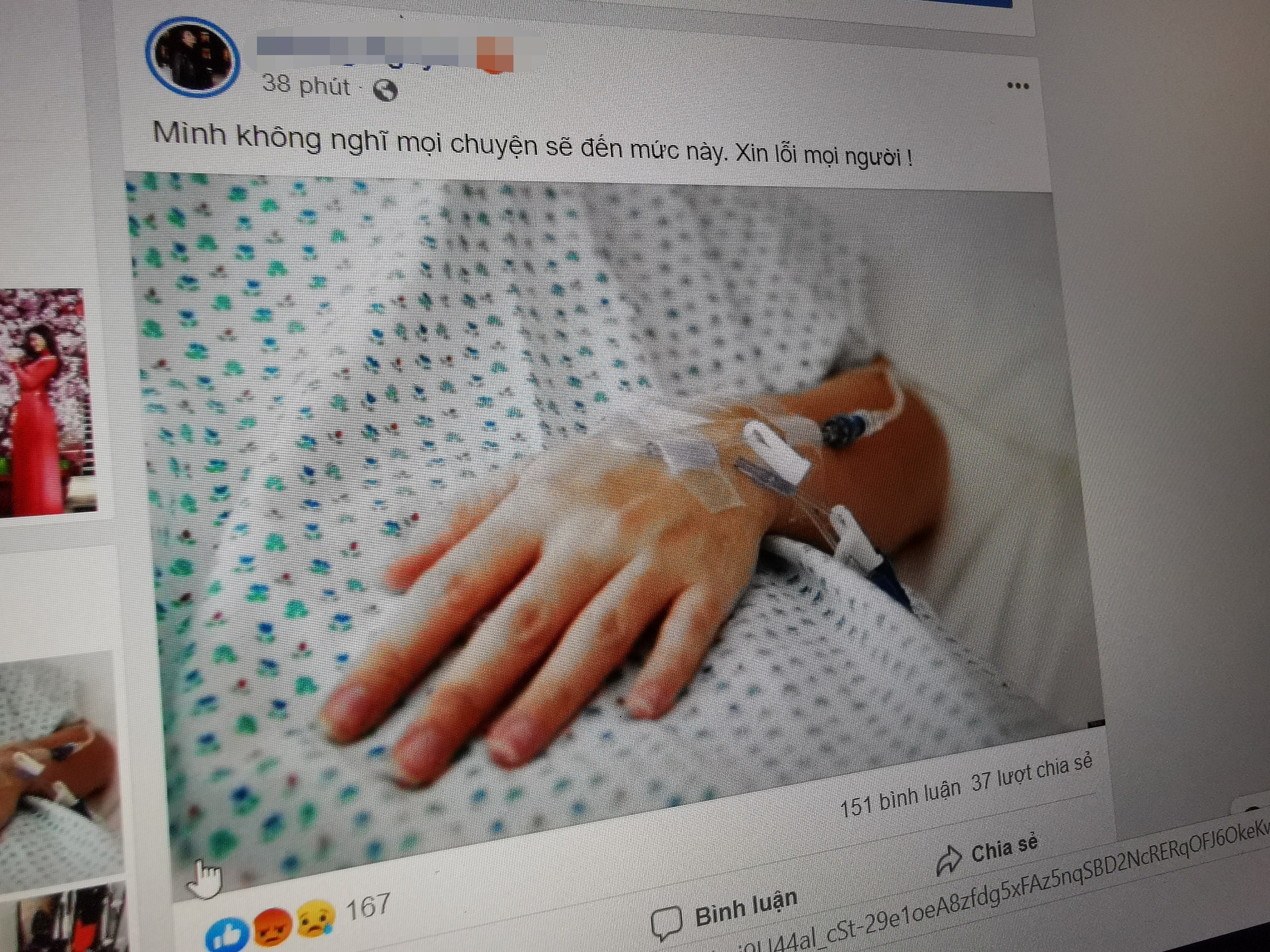 duong tinh covid-19 anh 1