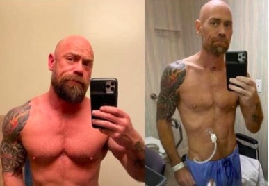 Buc anh benh nhan sut 23 kg vi Covid-19 gay chu y tren Internet hinh anh