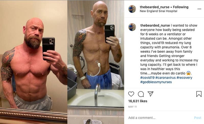 benh nhan covid-19 anh 2