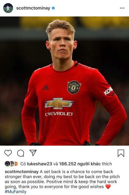 McTominay du kien nghi thi dau 8 tuan anh 2