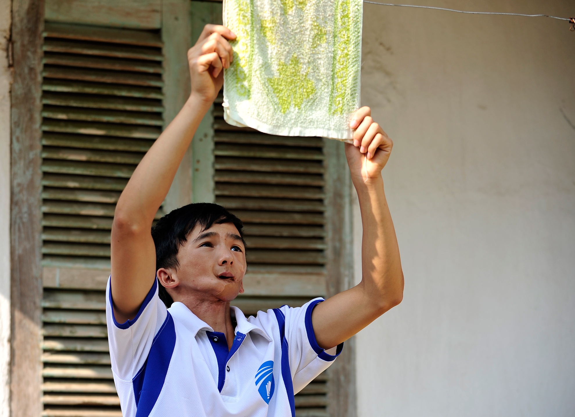 Tam su cua gia dinh chang trai co khuon mat bien dang hinh anh