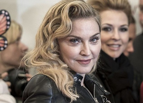 Madonna lo mat sung phu vi tiem botox hinh anh