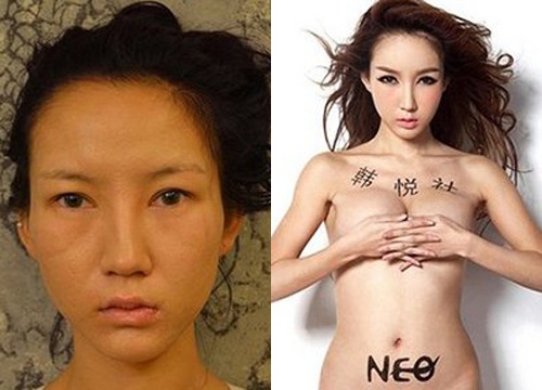 Nguoi mau Cbiz cong khai anh tham my gay shock hinh anh