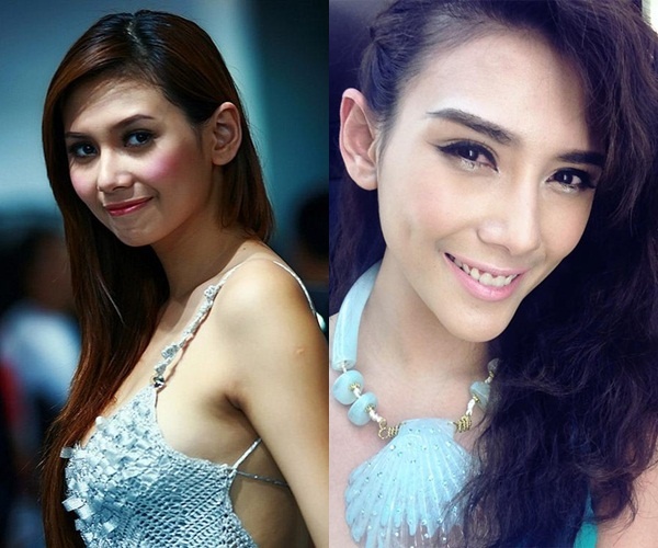 Cằm nhọn, V-line, sao Việt, Hồ Quỳnh Hương, Đinh Ngọc Diệp