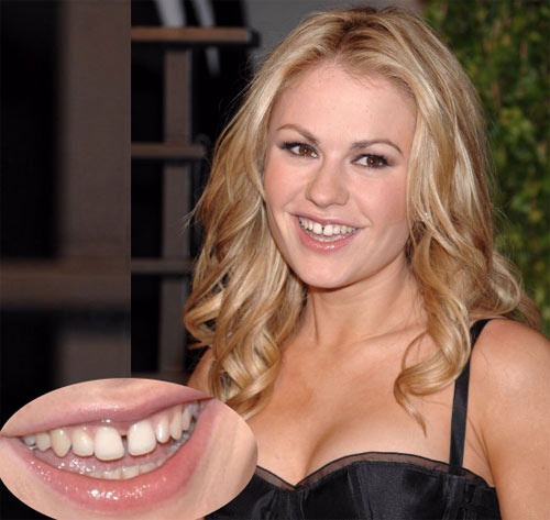 Anna Paquin  Người đẹp của loạt phim ăn khách 