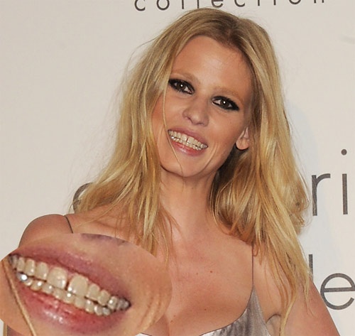 Người mẫu Lara Stone   Người mẫu Hà Lan Lara Stone từng bị chê bai suốt thời niên thiếu vì hàm răng với kẽ hở rộng hoác. Tuy vậy, cô cũng không có ý định chỉnh sửa lại bộ nhai bởi nó biến chủ nhân trở thành một biểu tượng đặc biệt trong làng thời trang.