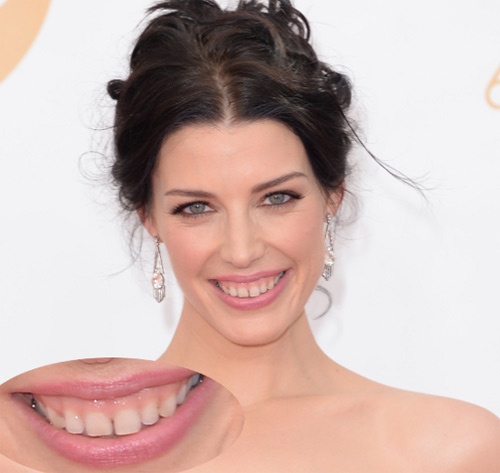 Jessica Paré  Sao truyền hình sẽ rất xinh đẹp nếu như không có nụ cười hở lợi. Mặc dù vậy, hàm răng đặc biệt của cô lại chính là lý do khiến cô lọt vào mắt xanh của đạo diễn phim 