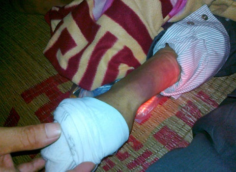 Nguoi dan ong tan cong 2 canh sat bi bat hinh anh