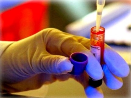 Bac si giup pham nhan tai ngoai bang cach 'chung nhan HIV' hinh anh