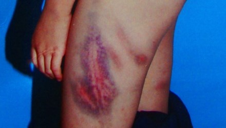 'Me ke doc ac' se dua ra xet xu cuoi thang 6 hinh anh