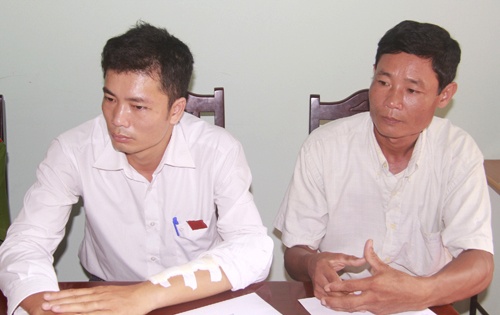 Bi chem dut gan tay, Truong CA xa van quyet bat ke trom cho hinh anh