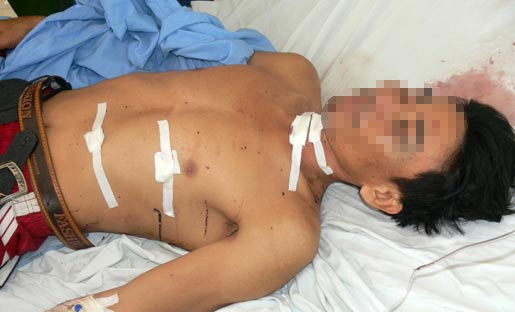 Dung keo giet ban gai da man roi tu sat hinh anh