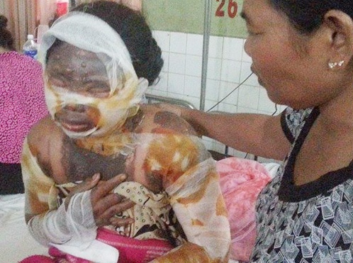 Nghi an cha duong thieu song con rieng cua vo vi bi choi yeu hinh anh