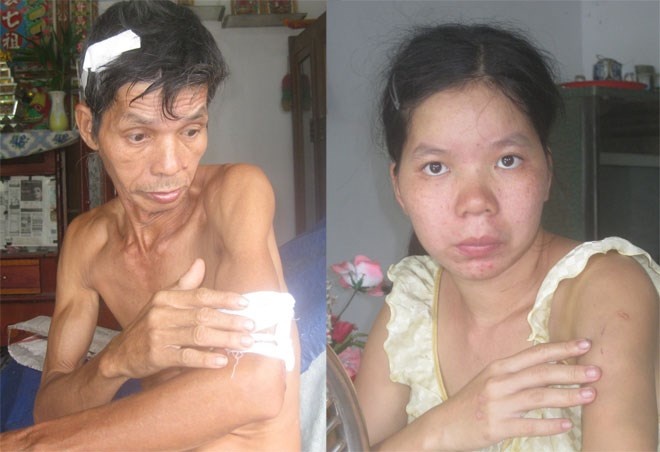 Nghi vo ngoai tinh, chang re mang dao di doat mang cha vo hinh anh