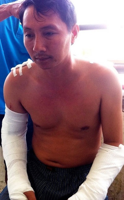 Ông Phan Văn Minh bị 3 kẻ bịt mặt truy sát, chém đứt gân 2 tay.