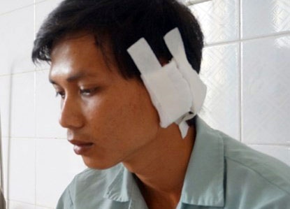 Bom nhau chem dan phong suyt rot tai hinh anh