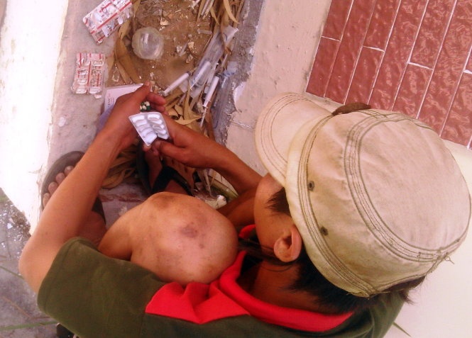 Nan chich thuoc gay nghien Di-Angesic hinh anh