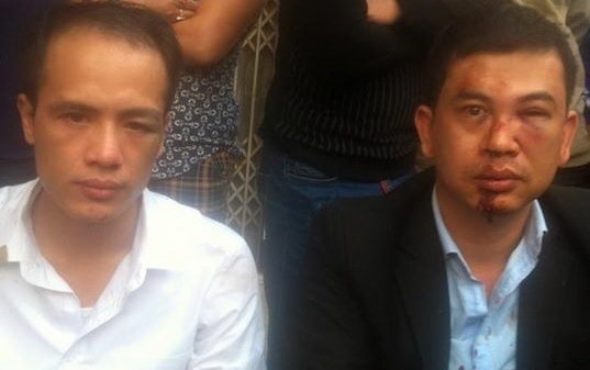 Dai bieu Quoc hoi de nghi khoi to vu an hai luat su bi danh hinh anh