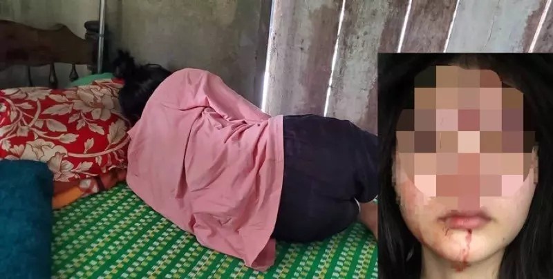 Dùng mũ bảo hiểm đánh thương tích ảnh 1 Dung mu bao hiem danh thuong tich anh 1