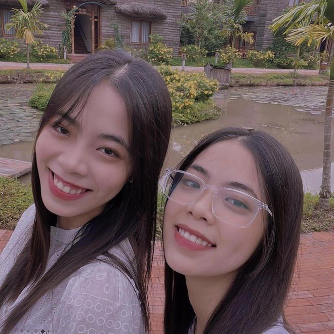 Ba cap chi em song sinh deu hoc gioi anh 3