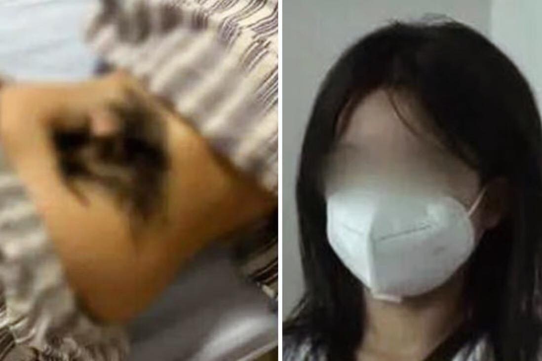 Co gai mac benh la khien long moc day o lung hinh anh