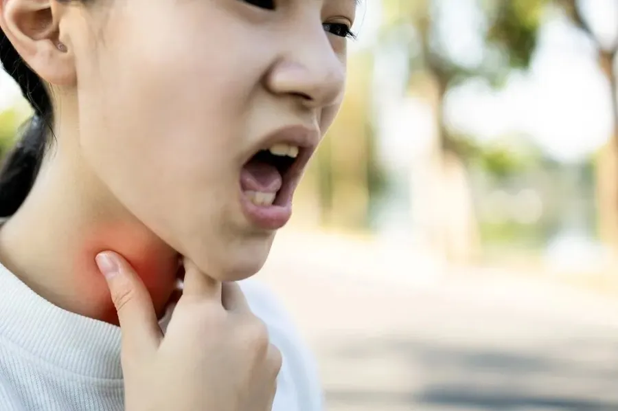 sỏi amidan,  đốm trắng ảnh 1 soi amidan,  dom trang anh 1