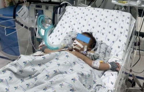 Cuu song nhieu tre mac tay chan mieng hinh anh