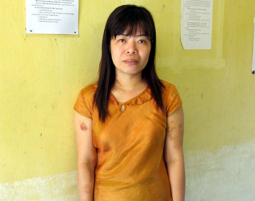 Nu giao vien bi chi dau dung bua tan cong, phong hoa giet hinh anh