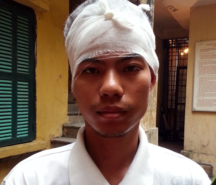 Ve si giet nguoi tung co tien su benh tam than hinh anh