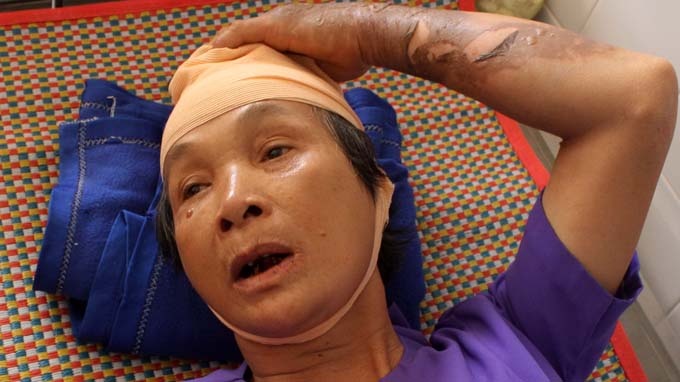 Tim hieu vu cu ba bi giat bong 13% vi cam dien thoai ban hinh anh