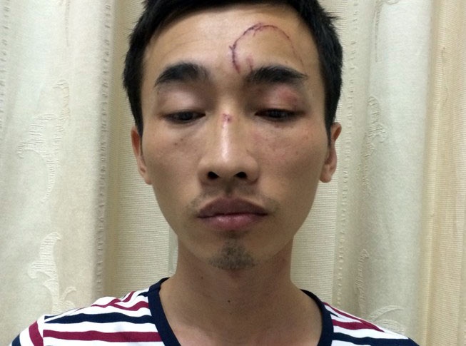 Ga trai chuyen rinh phu nu tam de trom iPhone hinh anh