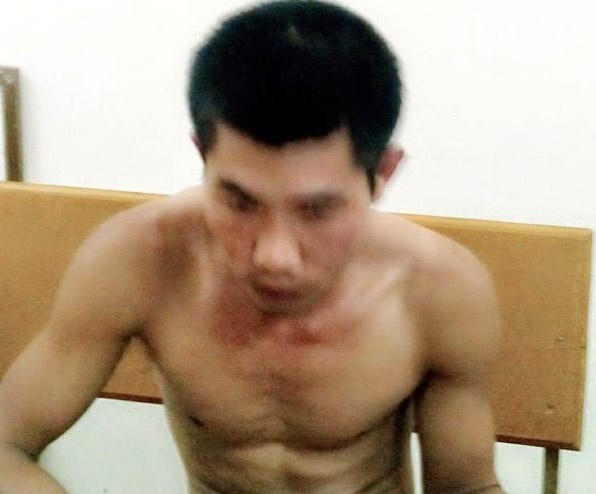 Hung thủ bị bắt ngay sau khi gây án.