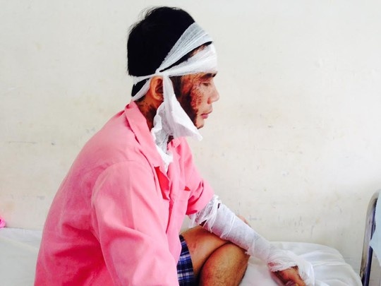 Quan ly cong ty nuoc ngoai bi tat axit da man hinh anh