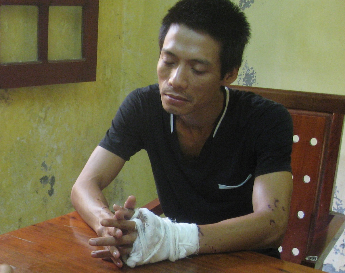 Ca si phong tra than nhien sau khi tat ca axit vao vo hinh anh