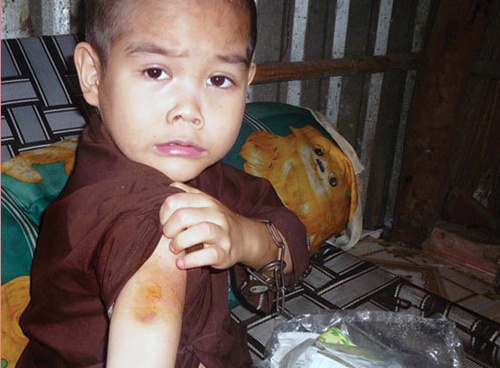 Bon dua tre bi bao hanh nhieu nam lien, chinh quyen tho o hinh anh