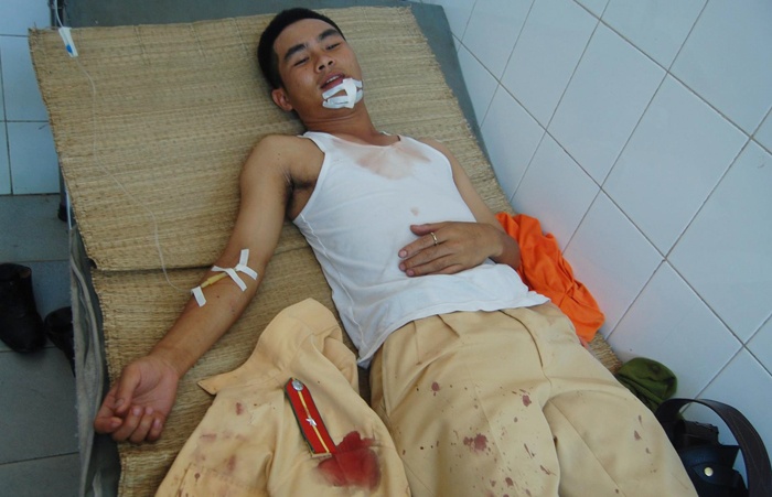 Canh sat tre tay khong bat con do trom xe mang dao bau hinh anh