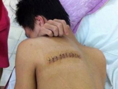 Nam sinh bi con do chem rach lung truoc cong nha hinh anh