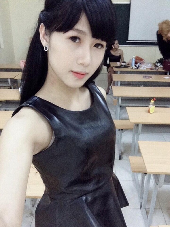 Đầu năm 2014, Hiếu được phẫu thuật mặt trong khoảng 2 giờ. Sau 3 tháng phục hồi, trị liệu, cậu sở hữu một khuôn mặt mới, hoàn hảo. Qua công nghệ lăng xê, cái tên 