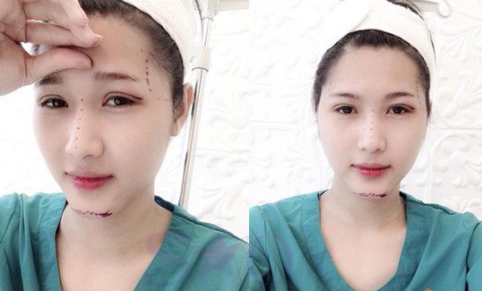 Thanh niên 21 tuổi kể sau cuộc thi Idol, một thẩm mỹ viện nổi tiếng có đề nghị tài trợ phẫu thuật chuyển giới cho cậu. 