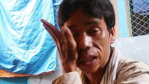 Vu cat dau phan xac: Bi kich tu doi song tinh duc benh hoan hinh anh