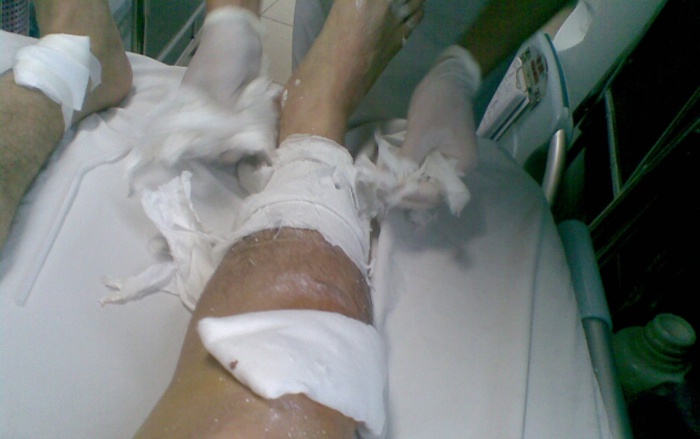 Các nạn nhân bị thương tích nặng, phải cấp cứu ở bệnh viện.