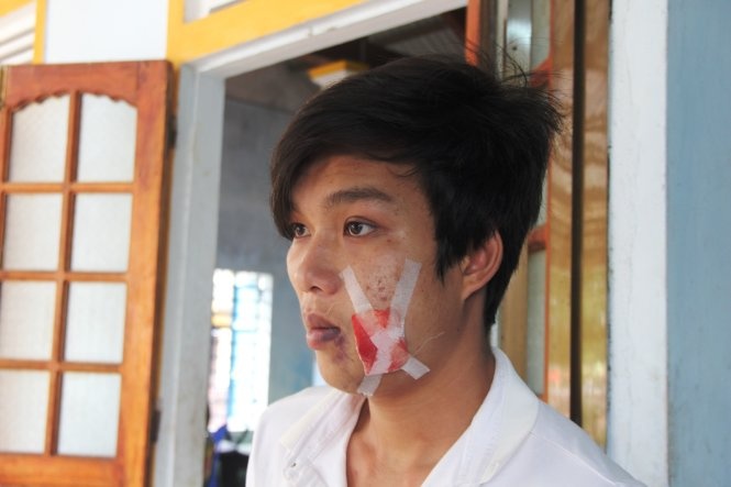 Thanh nien nhap vien vi trung dan cua cong an xa hinh anh