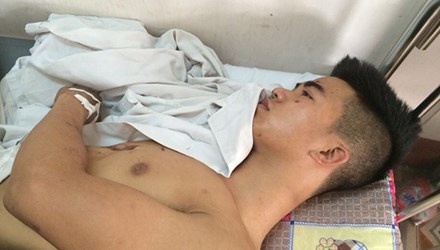 Ke si tinh het 'anh yeu em' roi om nu sinh tu sat hinh anh