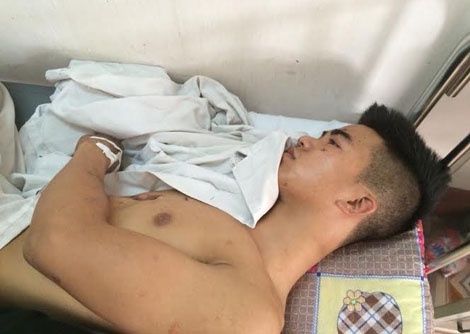 Khoi to thanh nien om thieu nu roi no min tu sat hinh anh