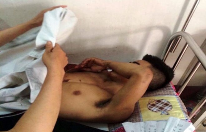 Tâm lý Tuấn bất ổn khi nằm điều trị tại bệnh viện. Ảnh: Q.Anh.