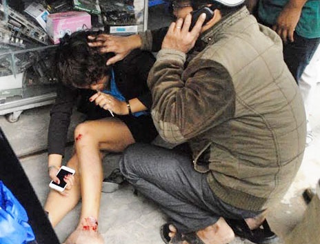 Co gai duoi theo hai ten cuop bi tai nan hinh anh