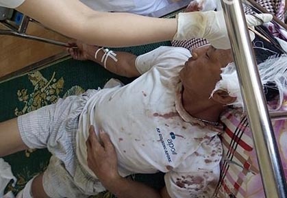 Ông Trần Minh Đố, nạn nhân trong vụ truy sát kinh hoàng vẫn đang được cấp cứu tại Bệnh viện Đa khoa Kinh Môn
