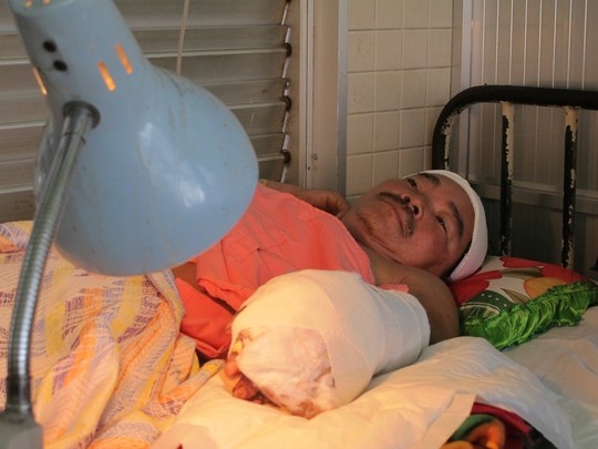 Ngan hang xom chui nhau, bi chat rot tay hinh anh