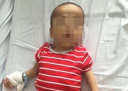 Be 5 tuoi bi cho can dut 'cua quy' hinh anh