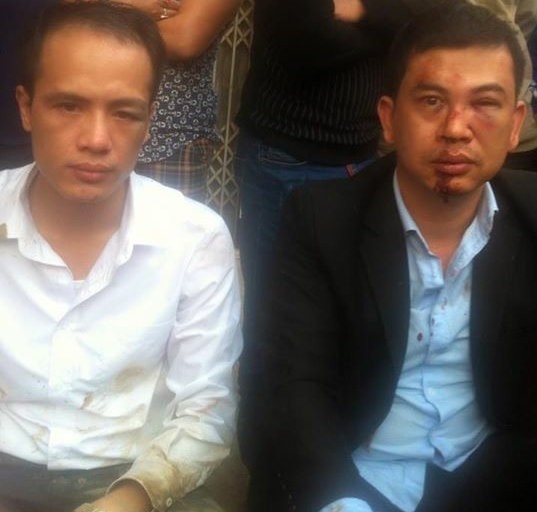 Hai luật sư bị đánh.